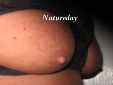 male breast enhancement pictures